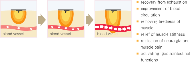 Acupuncture treatment effect image